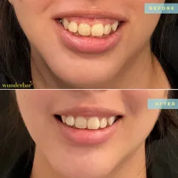 Korman Wine Festival - Korman