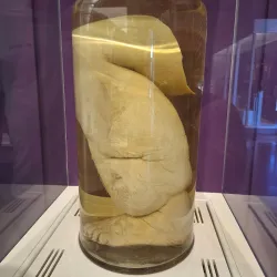 National Museum of Health and Medicine - Silver Spring